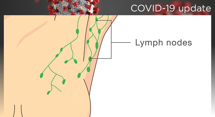 Swollen lymph nodes covid vaccine